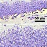 Dentate Gyrus of the Hippocampus (unexposed)