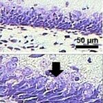 Dentate Gyrus of the Hippocampus (exposed)