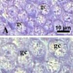 Dentate Gyrus of the Hippocampus (unexposed, magnified)