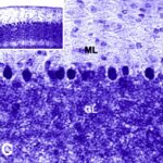 Cerebellar Cortex (exposed)