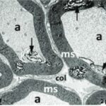 Trigeminal Nerve and Myelin Sheath (exposed, magnified)