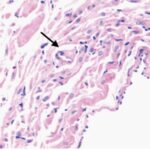 Sinus node (exposed, month 9)