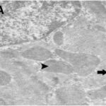 Cardiac Muscle (magnified, unexposed)