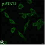 活性化したSTAT3(被曝無し)