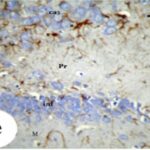 Reactive Astrocyte in the Ammon's Horn of the Hippocampus (exposed)