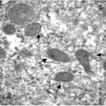 Astrocyte (unexposed)