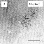 Striatum (unexposed)