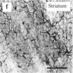 Striatum (exposed)