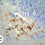 Reactive Astrocyte in the Dentate Gyrus of the Adult Hippocampus (exposed)