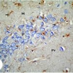 Reactive Astrocyte in the Ammon's Horn of the Adult Hippocampus (exposed)