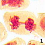 Chromosome Bridge No.1