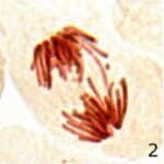 Chromosome Bridge No.2