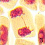 Chromosome Bridge No.3