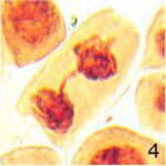 Chromosome Bridge No.4