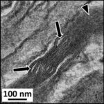 Myelin Sheath in Cerebral Cortex No.1 (exposed)