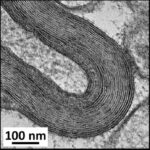 Myelin Sheath in Cerebral Cortex No.2 (unexposed)